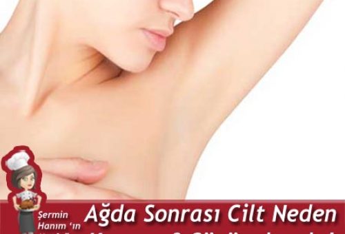 Ağda Sonrası Cilt neden Kararır